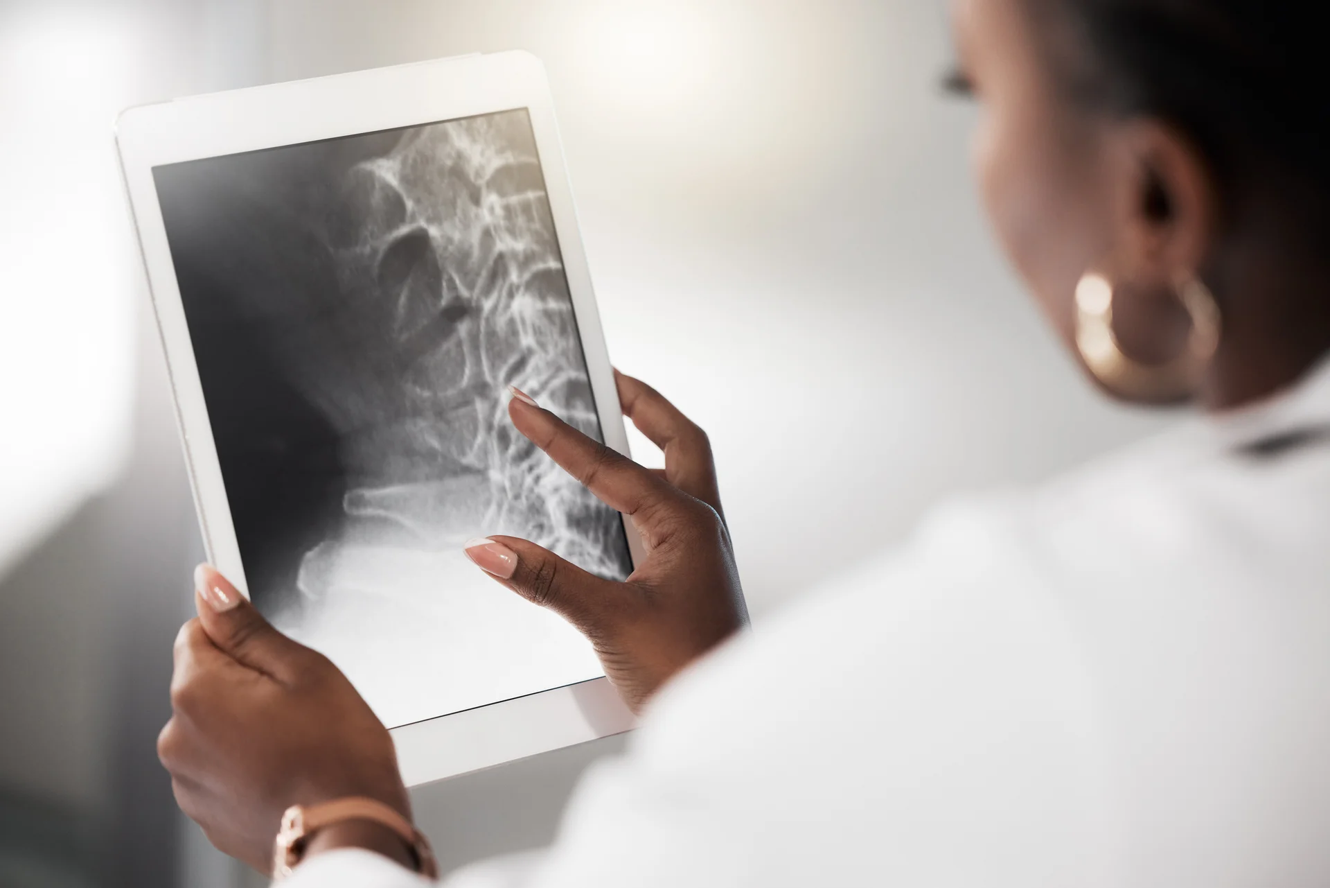 Digital X-ray analysis